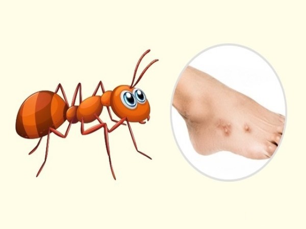 Lời giải nằm mơ thấy kiến lửa là điềm gì vận may đang đến? Lời giải nằm mơ thấy kiến lửa là điềm gì vận may đang đến?